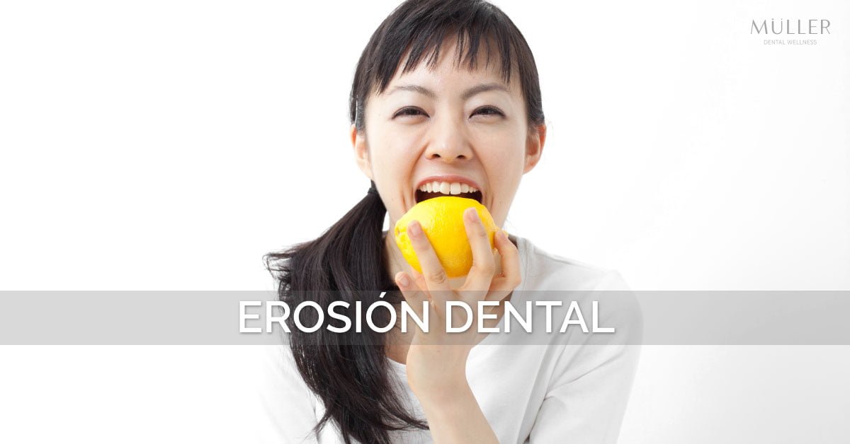 10 consejos para evitar la erosión dental