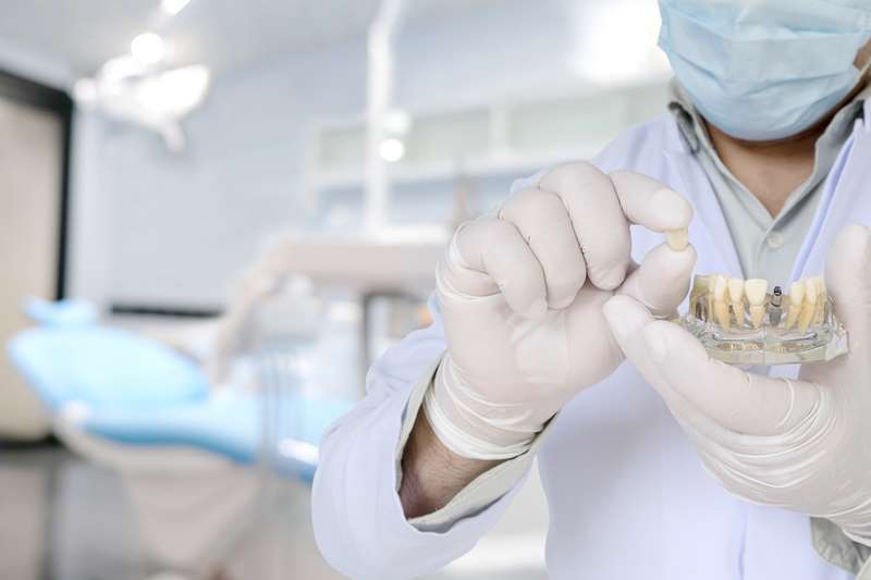 Dentista mostrando los implantes dentales en una maqueta bucal
