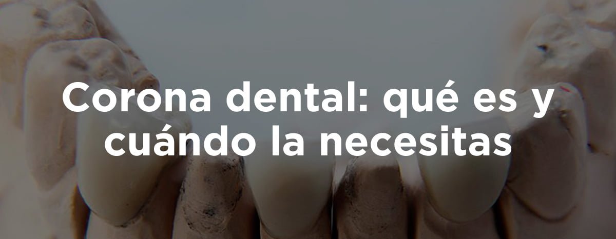 Corona dental: qué es y cuándo la necesitas